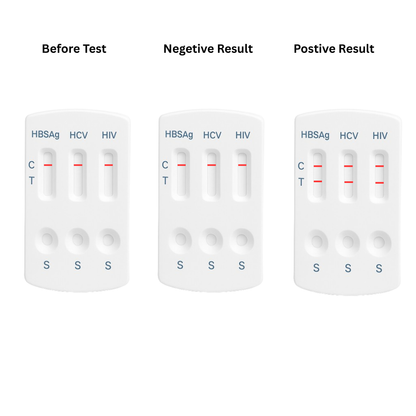 Three test card results: before, negative, and positive with HBsAg, HCV, HIV markers