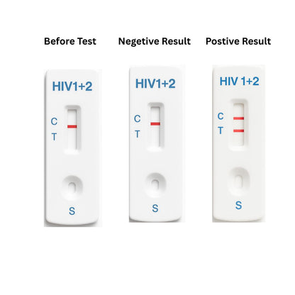 HIV test cassette cards showing before, negative, and positive C/T lines