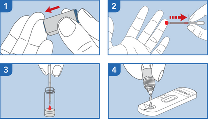 Step-by-step instructions for using an HIV 1/2 self-test device with blood sample